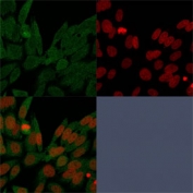Immunofluorescent staining of PFA-fixed human HeLa cells with IDH1 antibody (clone IDH1/1152, green) and Reddot nuclear stain (red).