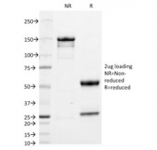 SDS-PAGE analysis of purified, BSA-free IgA antibody (clone IA761) as confirmation of integrity and purity.