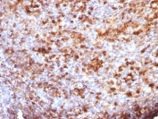 IHC: Formalin-fixed, paraffin-embedded human tonsil stained with anti-IgG antibody (B33/20)