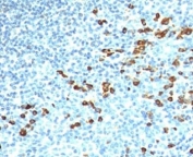IHC: Formalin-fixed, paraffin-embedded human tonsil stained with anti-IgM antibody (ICO-30)