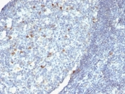 IHC: Formalin-fixed, paraffin-embedded human tonsil stained with anti-IgM antibody.