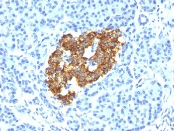 IHC: Formalin-fixed, paraffin-embedded human pancreas stained with Insulin antibody (IRDN/794).~