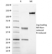 SDS-PAGE Analysis of Purified, BSA-Free CD41 Antibody (clone ITGA2B/1036). Confirmation of Integrity and Purity of the Antibody.