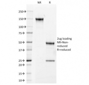 SDS-PAGE analysis of purified, BSA-free AR antibody (clone AR441) as confirmation of integrity and purity.