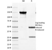 SDS-PAGE analysis of purified, BSA-free Androgen Receptor antibody (clone DHTR/882) as confirmation of integrity and purity.