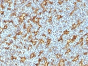 IHC testing of human tonsil with CD11c antibody (clone ITGAX/1242). Note specific staining of dendritic cells. Required HIER: boil tissue sections in 10mM Tris with 1mM EDTA, pH 9, for 10-20 min.