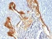 IHC: Formalin-fixed, paraffin-embedded human tonsil stained with Involucrin antibody (clone IVRN/827).