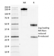 SDS-PAGE Analysis of Purified, BSA-Free c-Kit Antibody (clone KIT/982). Confirmation of Integrity and Purity of the Antibody.