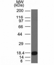 Western blot of a recombinant protein fragment with c-Kit antibody (KIT/982).