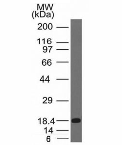 Western blot of a recombinant protein fragment with c-Kit antibody (KIT/983).~