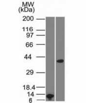 Western blot analysis of A) partial recombinant ARG1 protein and B) human liver lysate using Arginase 1 antibody (ARG1/1125). Predicted molecular weight ~35 kDa.