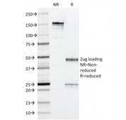 SDS-PAGE analysis of purified, BSA-free Arginase antibody (clone ARG1/1126) as confirmation of integrity and purity.