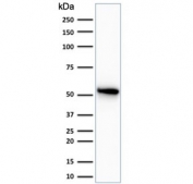 Western blot testing of human HeLa cell lysate with Cytokeratin 7 antibody (clone OV-TL12/30).
