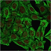 Immunofluorescent staining of methanol-fixed human HeLa cells with Cytokeratin 7 antibody.