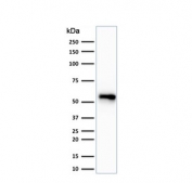 Western blot testing of human HeLa cell lysate with Keratin 7 antibody. Predicted molecular weight ~51 kDa.