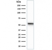 Western blot testing of human HeLa cell lysate with Cytokeratin 7 antibody (clone K72.7).