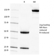 SDS-PAGE analysis of purified, BSA-free Cytokeratin 7 antibody (clone KRT7/903) as confirmation of integrity and purity.