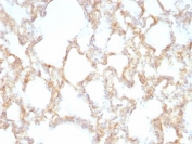 IHC: Formalin-fixed, paraffin-embedded rat lung stained with Keratin 7 antibody (KRT7/1198)