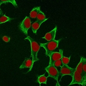Immunofluorescent staining of permeabilized human MCF7 cells with Cytokeratin 8 antibody (clone B22.1, green) and Reddot nuclear stain (red).