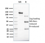 SDS-PAGE analysis of purified, BSA-free Cytokeratin 8 antibody (clone B22.1) as confirmation of integrity and purity.