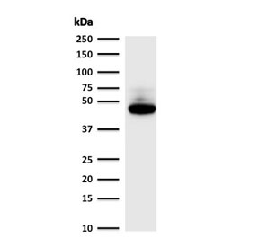 Western blot testing of human MCF7 cell lysate with Cytokeratin 8 antibody (clone C-43).~