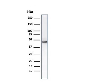 Western blot testing of human HCT-116 cell lysate with Cytokeratin 8 antibody (clone C-43).