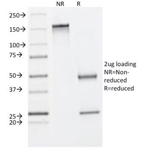 SDS-PAGE Analysis of Purified, BSA-Free Cytokeratin 8 Antibody (clone C-43). Confirmation of Integrity and Purity of the Antibody.