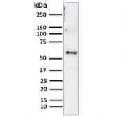 Western blot testing of human thymus lysate with Keratin 10 antibody (clone KRT10/844). Predicted molecular weight ~59 kDa.