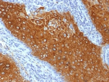 IHC testing of FFPE human skin with Keratin 10 antibody (clone KRT10/844). Required HIER: boil tissue sections in 10mM citrate buffer, pH 6.0, for 10-20 min.~