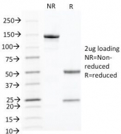 SDS-PAGE analysis of purified, BSA-free Keratin 10 antibody (clone KRT10/844) as confirmation of integrity and purity.