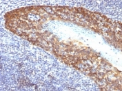 IHC: Formalin-fixed, paraffin-embedded human tonsil stained with Keratin 14 antibody (KRT14/532).