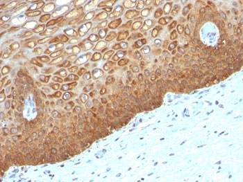 IHC: Formalin-fixed, paraffin-embedded human cervix stained with Keratin 14 antibody (KRT14/532).~