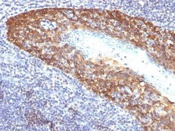 IHC: Formalin-fixed, paraffin-embedded human tonsil stained with Keratin 14 antibody (KRT14/532).