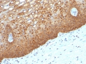 IHC: Formalin-fixed, paraffin-embedded human cervix stained with Keratin 14 antibody (KRT14/532).