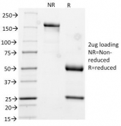 SDS-PAGE Analysis of Purified, BSA-Free Cytokeratin 17 Antibody (clone KRT17/778). Confirmation of Integrity and Purity of the Antibody.