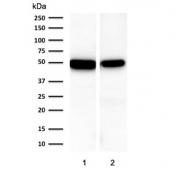 Western blot testing of human 1) stomach and 2) intestine lysate using Keratin 18 antibody (clone KRT18/1190). Predicted molecular weight ~48 kDa.