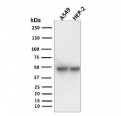 Western blot testing of human A549 and HEP-2 cell lysate using Keratin 18 antibody (clone KRT18/1190). Predicted molecular weight ~48 kDa.