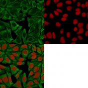 Immunofluorescent staining of permeabilized human HeLa cells with Cytokeratin 18 antibody (green, clone DE-K18) and Reddot nuclear stain (red).