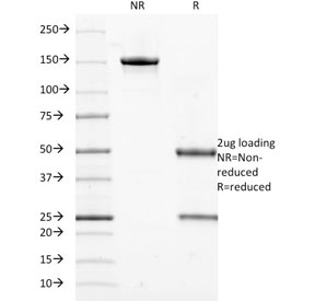 SDS-PAGE analysis of purified, BSA-free Cytokeratin 18 antibody (clone DE-K18) as confirmation of integrity and purity.