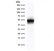 Western blot testing of MCF7 cell lysate with Cytokerain 18 antibody (clone DE-K18). Expected molecular weight: 46-50 kDa.