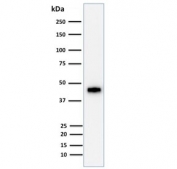 Western blot testing of HCT116 cell lysate with Cytokerain 18 antibody (clone DE-K18). Expected molecular weight: 46-50 kDa.
