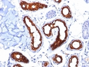 IHC: Formalin-fixed, paraffin-embedded human skin stained with Cytokeratin 18 antibody (KRT18/834).