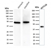 Western blot testing of human stomach, intestine and HCT-116 cell lysate with Cytokeratin 18 antibody (clone KRT18/834). Predicted molecular weight ~48 kDa.