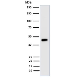 Western blot testing of HCT116 cell lysate with Cytokerain 18 antibody (clone KRT18/835). Expected molecular weight: 46-50 kDa.