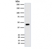 Western blot testing of HCT116 cell lysate with Cytokerain 18 antibody (clone KRT18/835). Expected molecular weight: 46-50 kDa.