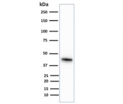Western blot testing of human HCT-116 cell lysate with CK18 antibody (clone KRT18/836). Predicted molecular weight ~48 kDa.