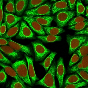 Immunofluorescent staining of human HeLa cells with CK18 antibody (clone KRT18/836, green) and Reddot nuclear stain (red).