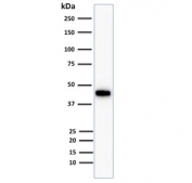Western blot testing of human HCT116 cells with Cytokeratin 18 antibody cocktail. Predicted molecular weight ~45 kDa.