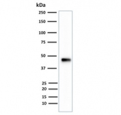 Western blot testing of human HCT-116 cell lysate with CK18 antibody (clone B23.1). Expected molecular weight: 46-50 kDa.