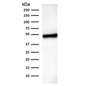 Western blot testing of human stomach lysate with CK18 antibody (clone B23.1). Expected molecular weight: 46-50 kDa.~